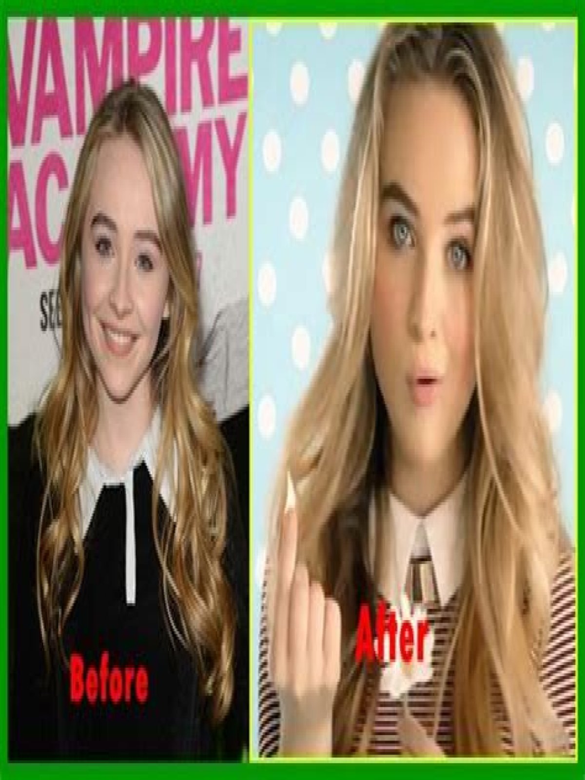 Exploring The Truth: Did Sabrina Carpenter Get A Nose Job?