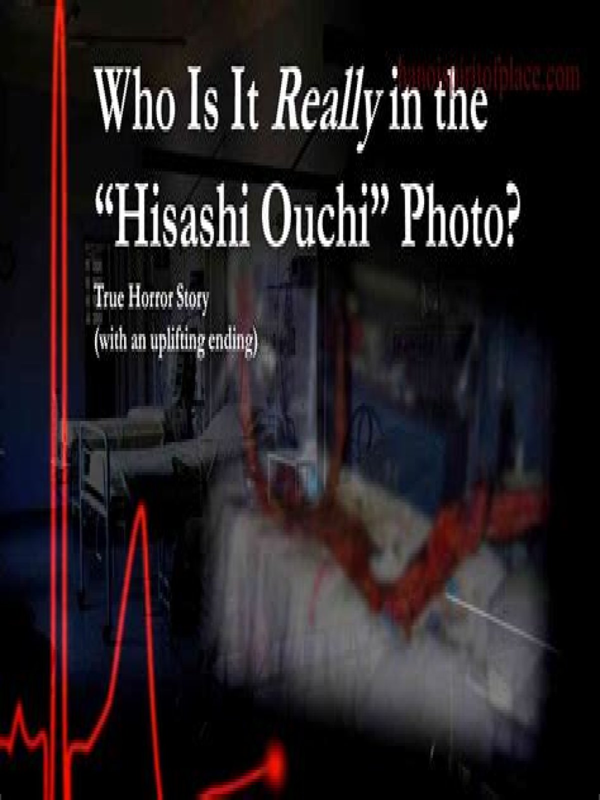 Unveiling The Tragic Story Behind Hisashi Ouchi Hospital Photos